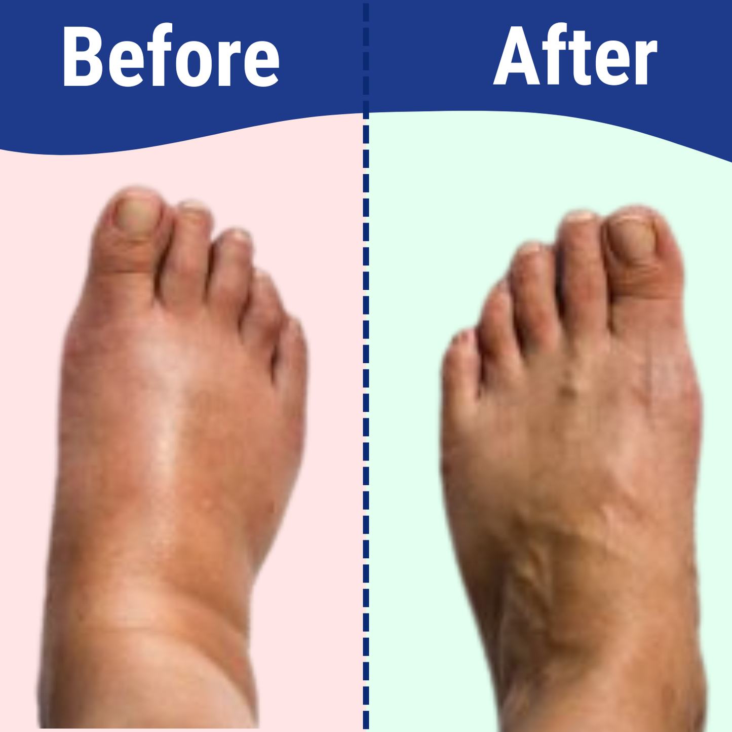 FootRenew™ by Dr. Schilling (2-Pack)